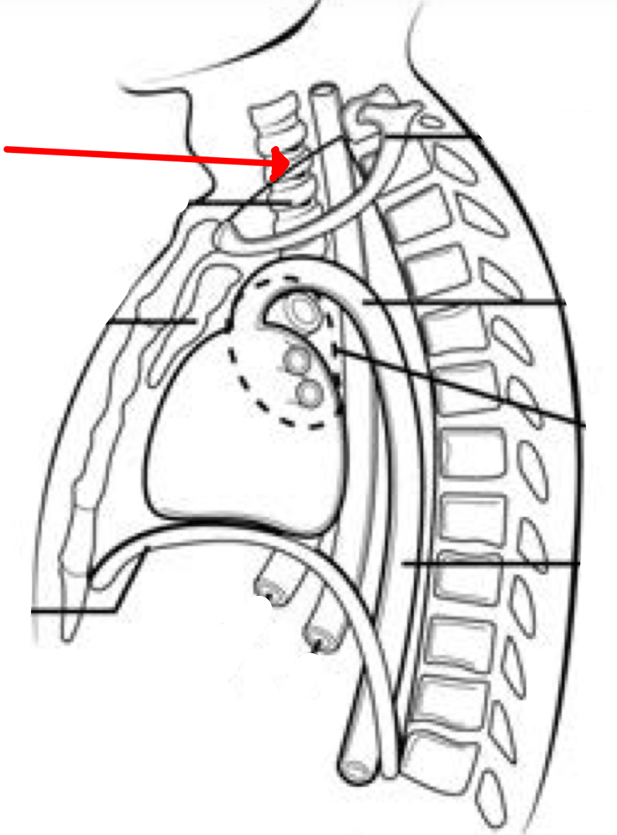 <p>Identify the organ the red arrow it pointing to.</p>
