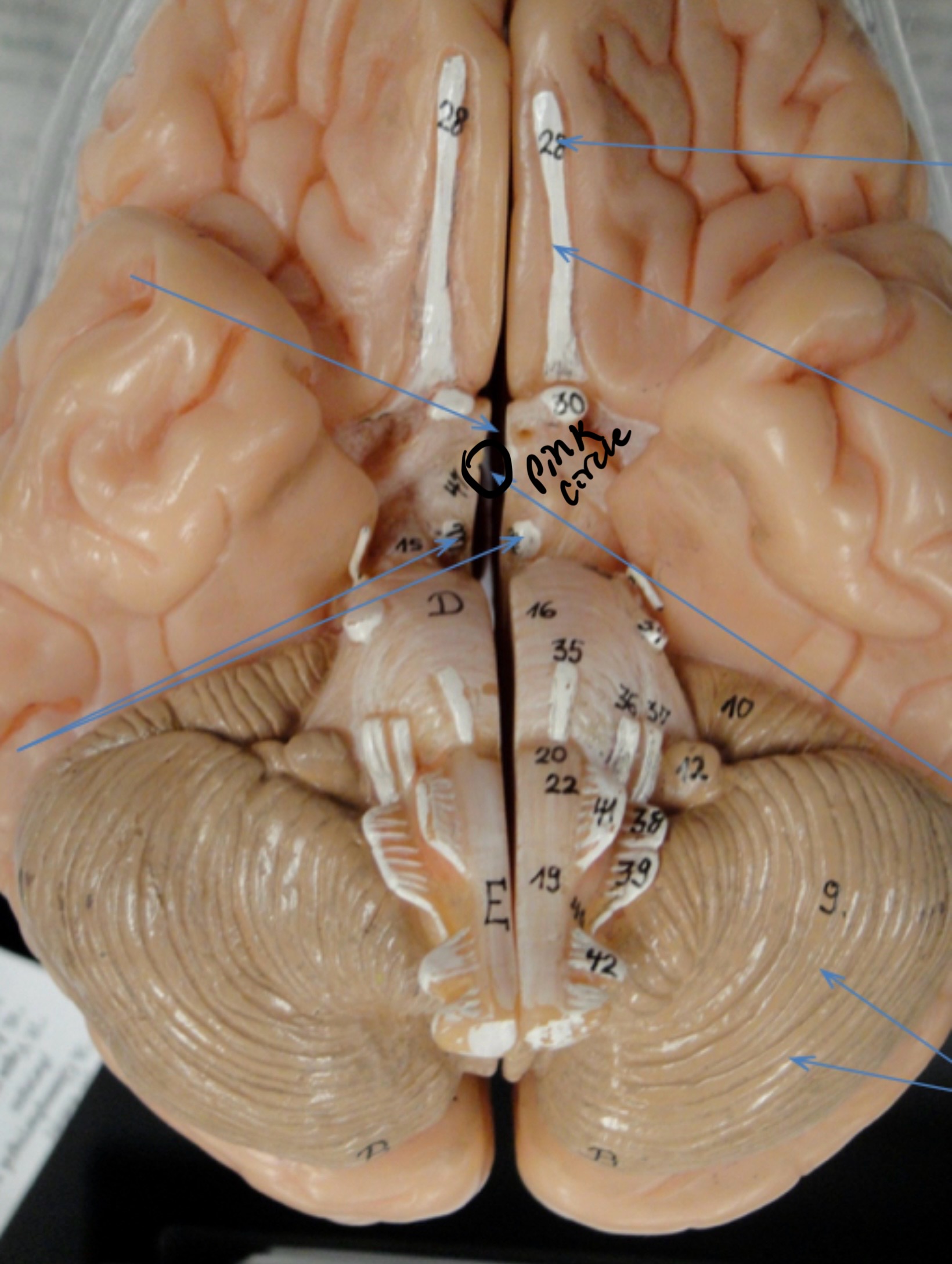 <p>Identify the circled area?</p>