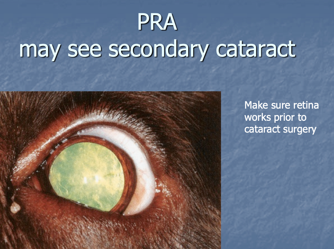 <p>secondary cataract - make sure that the retina works prior to catracts Sx.</p>
