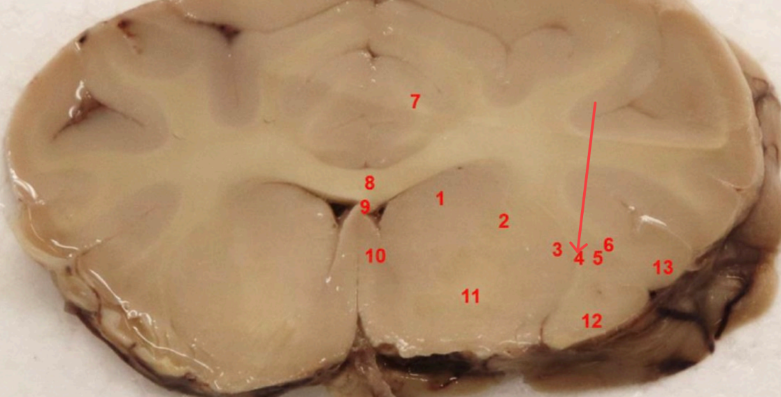 <p>what tract is this</p>