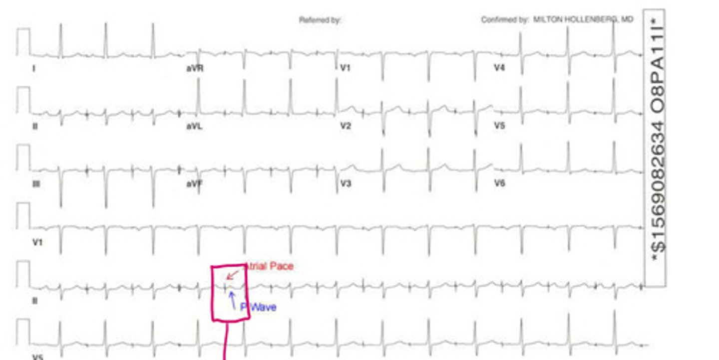 <p>this is an example of an _____ ______</p>