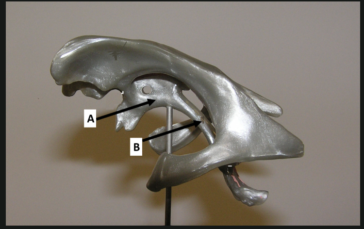 <p>What structure does the 3rd Ventricle sit between?</p>