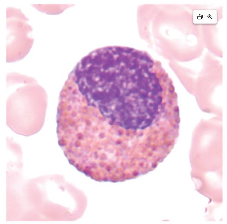 <p>what is an eosinophilic myelocyte?</p>