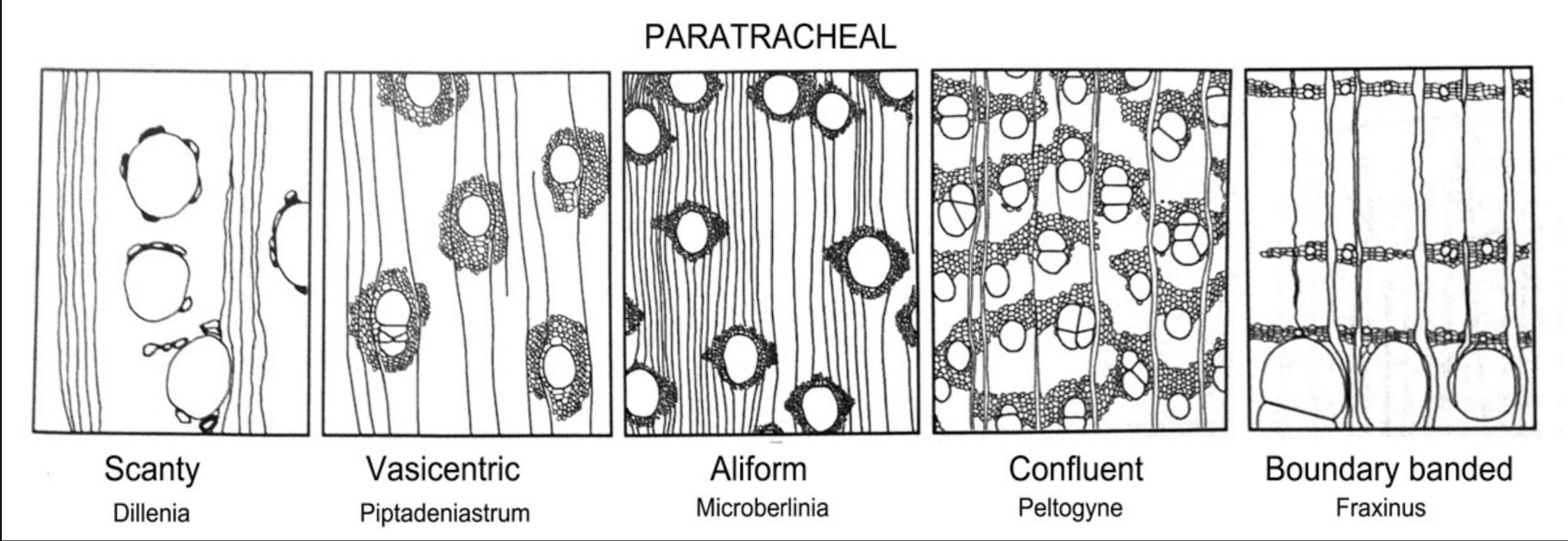 <p>associated with vessels</p><p>a. Scanty – scattered, usually solitary, next to vessels.</p><p>b. Vasicentric – surround the vessel.</p><p>c. Aliform (with wings) – AP surrounds the vessel and extends</p><p>to either side in wings.</p><p>d. Confluent – wings connect adjacent vessels.</p><p>e. Boundary banded – in growth ring, forms sheath around</p><p>vessels and narrow bands that connect with other vessels.</p>
