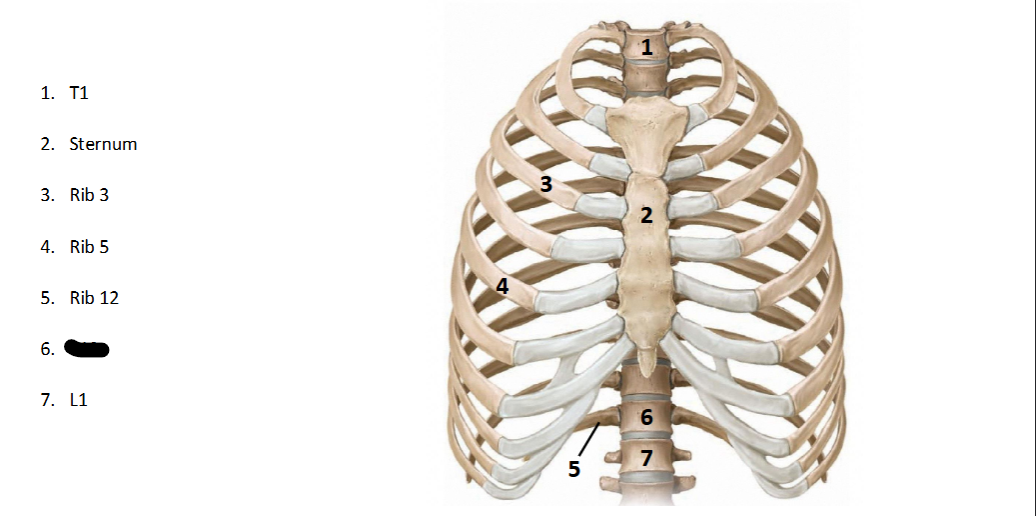 <p>What structure is this within the <strong>Spine? (ANTERIOR OF AXIAL)</strong></p>