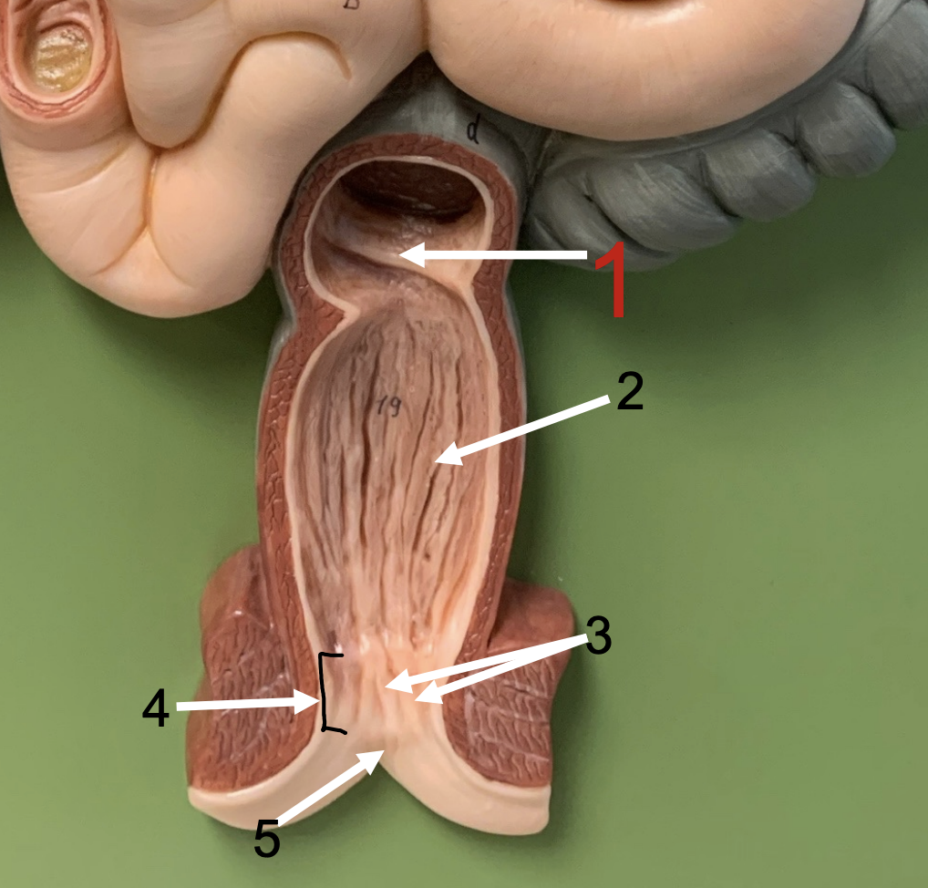 <p>identify 2, 3 (ridges), 4, 5, 6 (opening)</p>