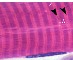 <p>split in half by a Z-line, one half sits in one muscle unit and the other half sits in the next</p>