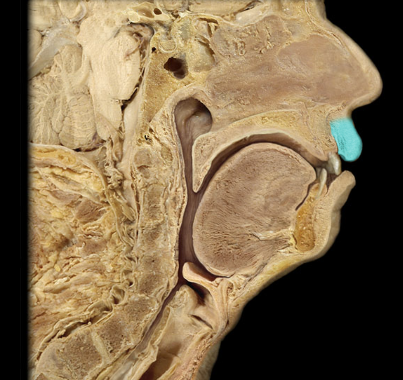 term image