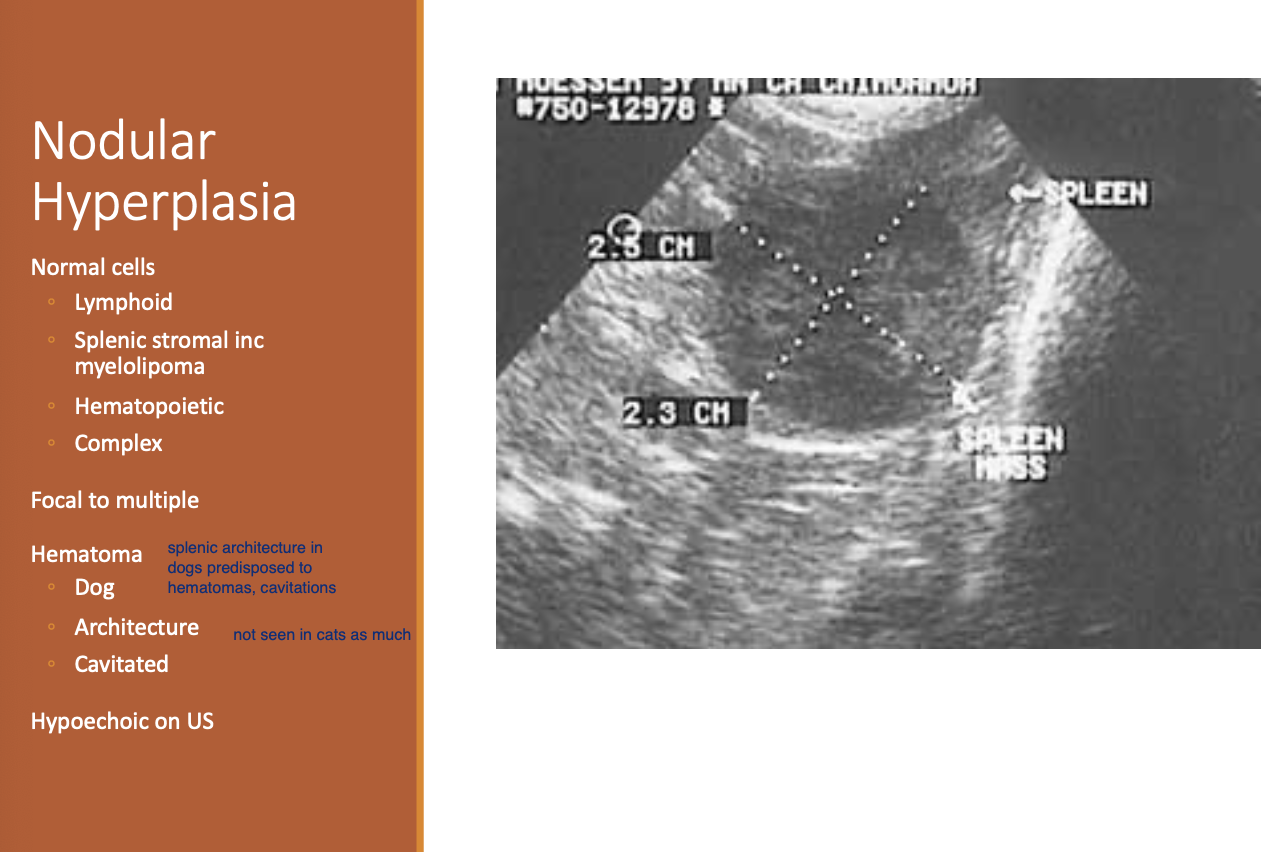 <p>Splenic myelolipoma.</p>