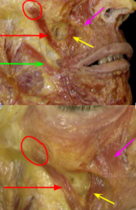 <p>Red circle =</p><p>Red arrow:</p><p>What is the central point of muscles:</p><p>Green arrow:</p><p>Pink:</p><p>yellow:</p>