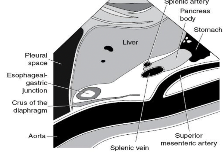 <ul><li><p>Longitudinal Proximal Aorta</p></li></ul><p></p>