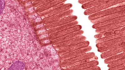 <p>Brush border</p>