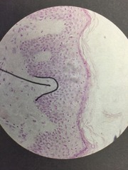 <p>Finger-like projections of the papillary layer</p><p>-Made up of areolar connective tissue</p>