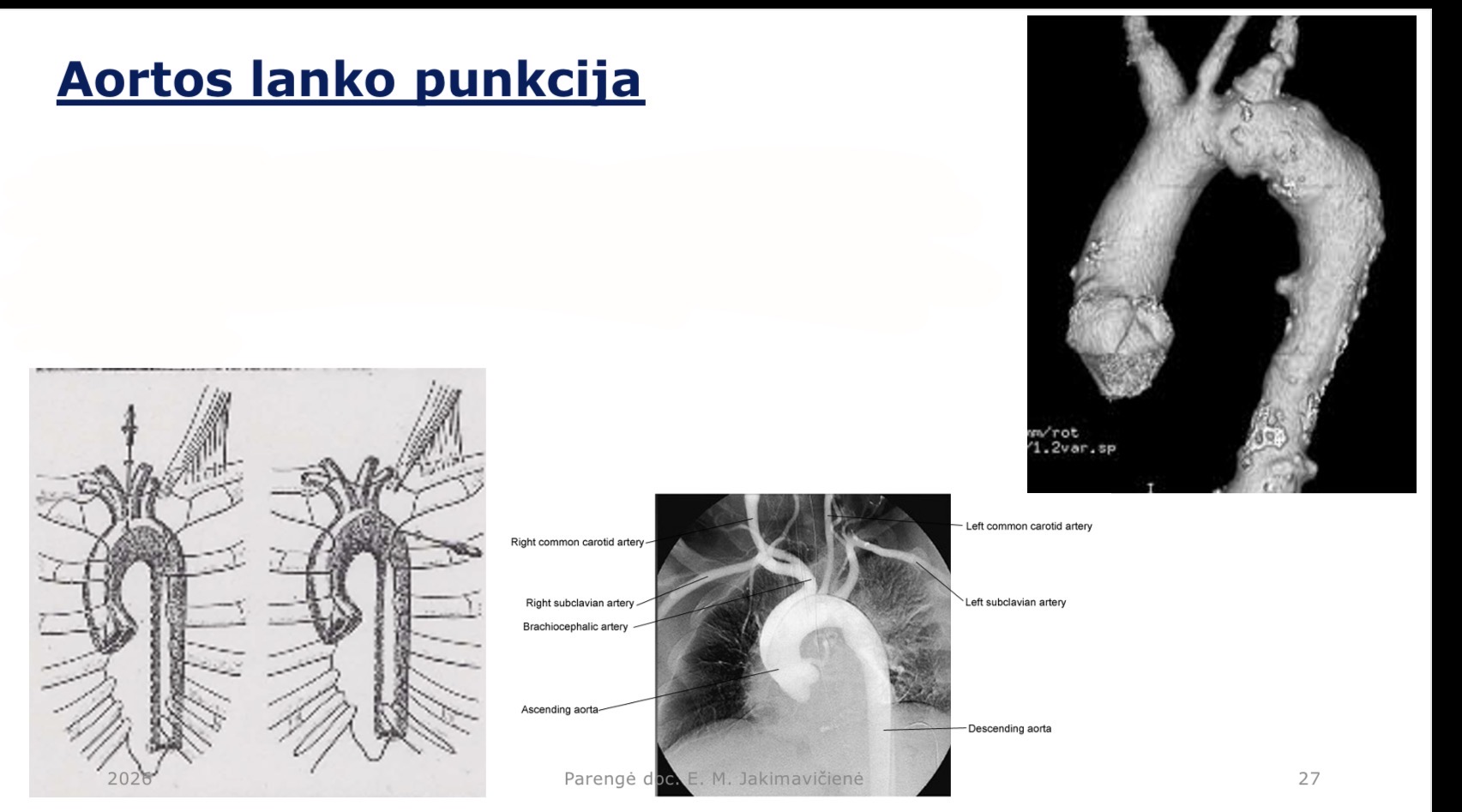 <p>Kur yra aortos lankas?</p>