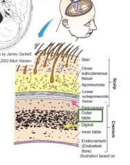 <p>On the external surface of the outer table is periosteum or pericranium, which is the 5th layer of the scalp</p><p>The external layer is called the OUTER TABLE and is made of compact bone</p>