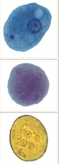 <p>Large, cyst form >4 nuclei, troph form has large karyosome and vacuolated/dirty cytoplasm</p>