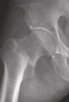 <p>localizacion?</p>