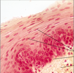 <p>name the tissue: thick epithelium composed of several cell layers; basal layers are cuboidal or columnar; surface layer are squamous</p>