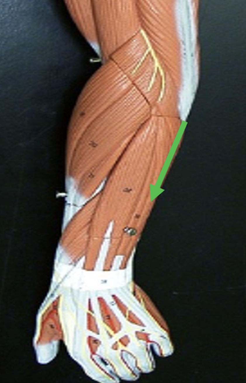 <p>Identify the muscle indicated by the pointer.</p>