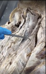 <p>Name the muscle</p><p>- specific area of longissimus</p>