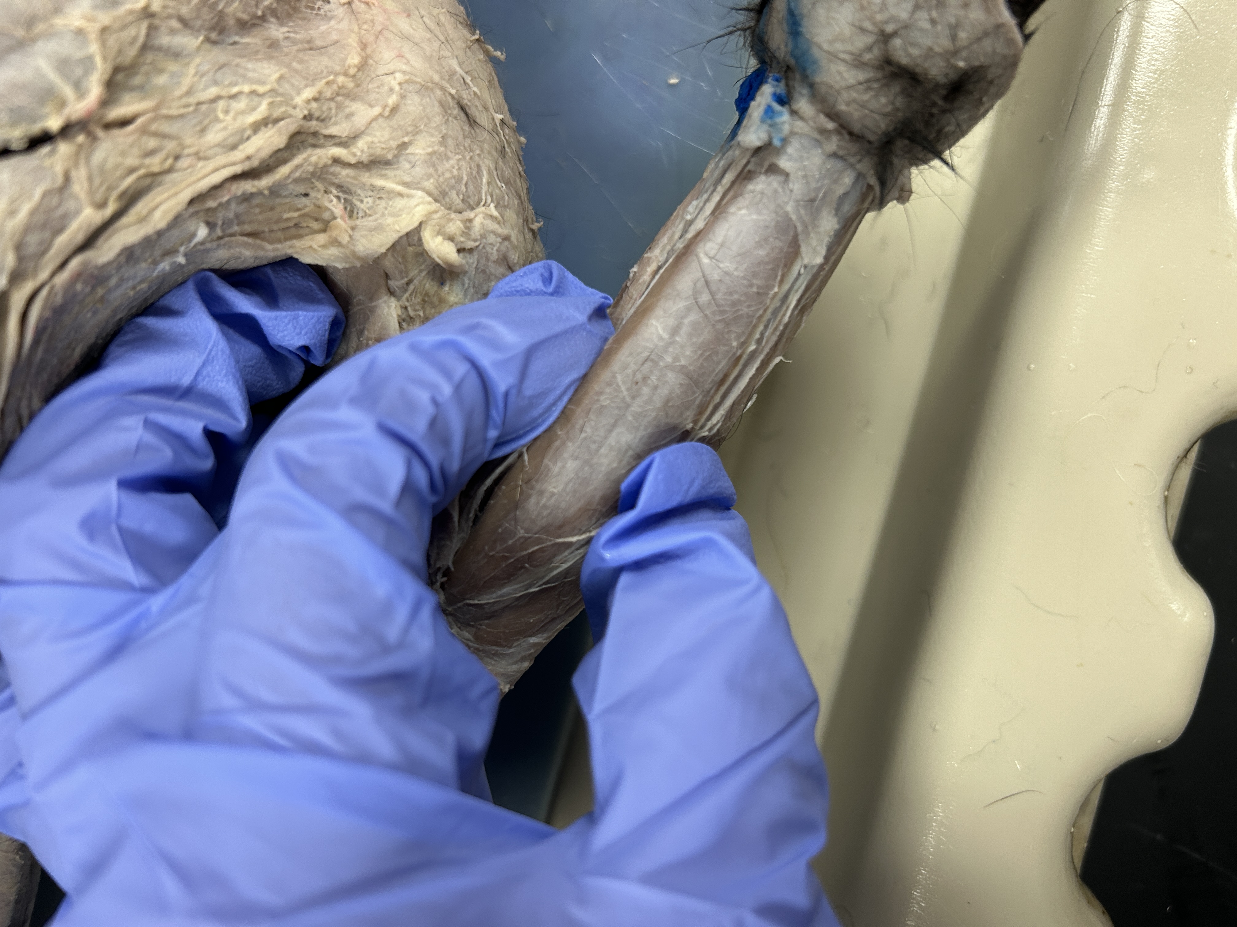 <p>Palmaris Longus </p>