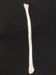<p>right or left?</p>