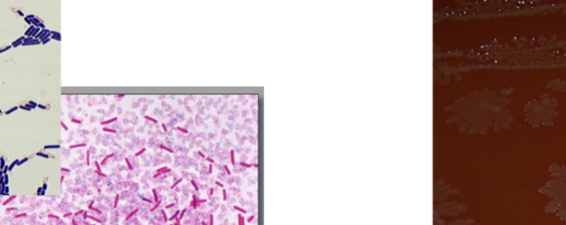 <p>GPR, straight, free oval or subterminal spores, single or pairs, ANA BAP- circular-irregular, mottled internal structure, scalloped or lobate margin, variable hemolysis</p>