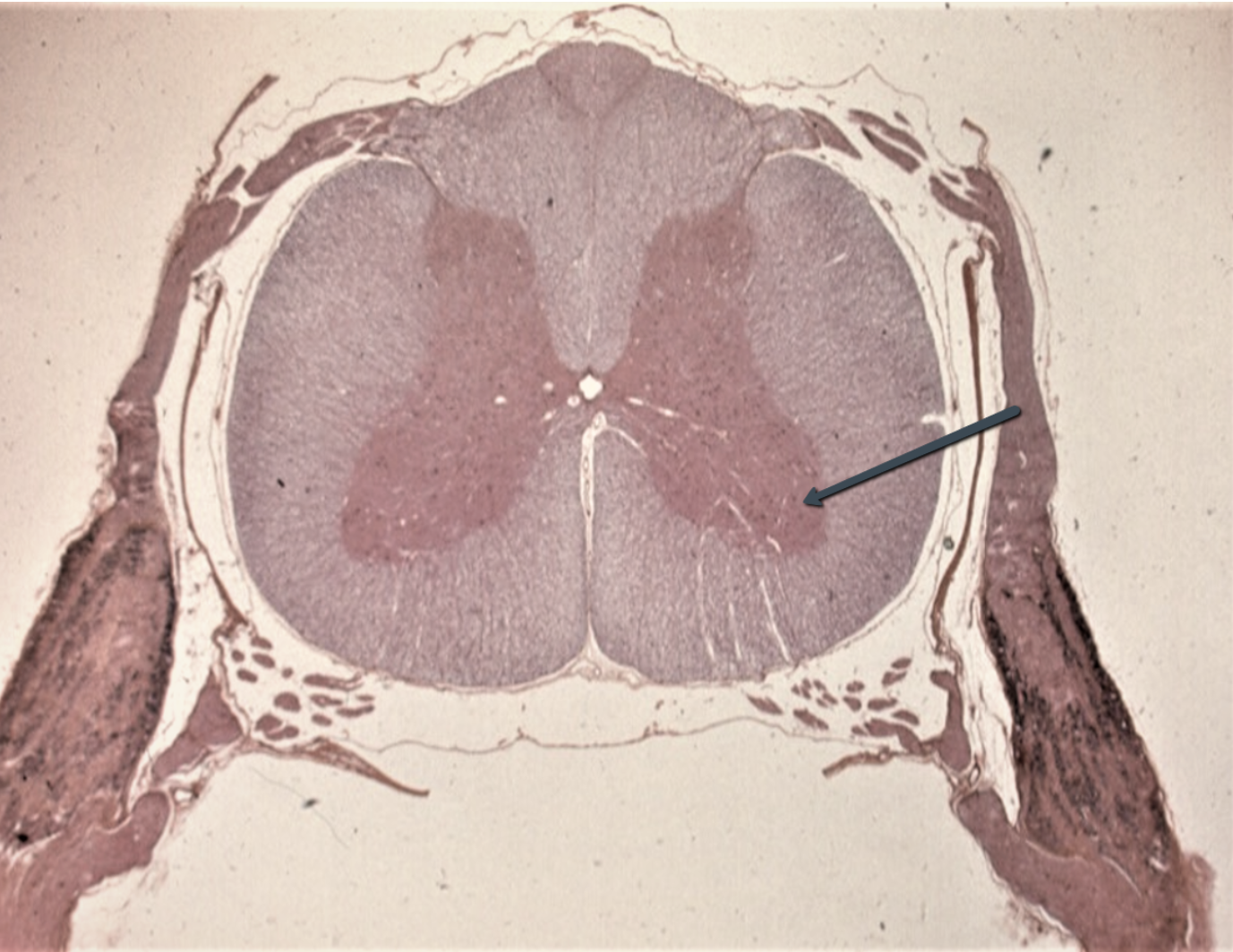 <p><span><strong>Identify the area indicated by the pointer.</strong></span></p>