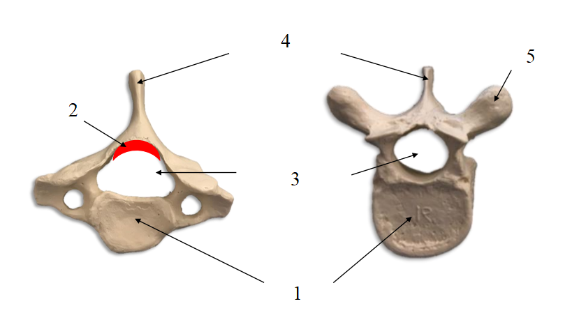 <ol><li><p>What kind of bones are these?</p></li><li><p>Name structures 1-5.</p></li></ol><p></p>