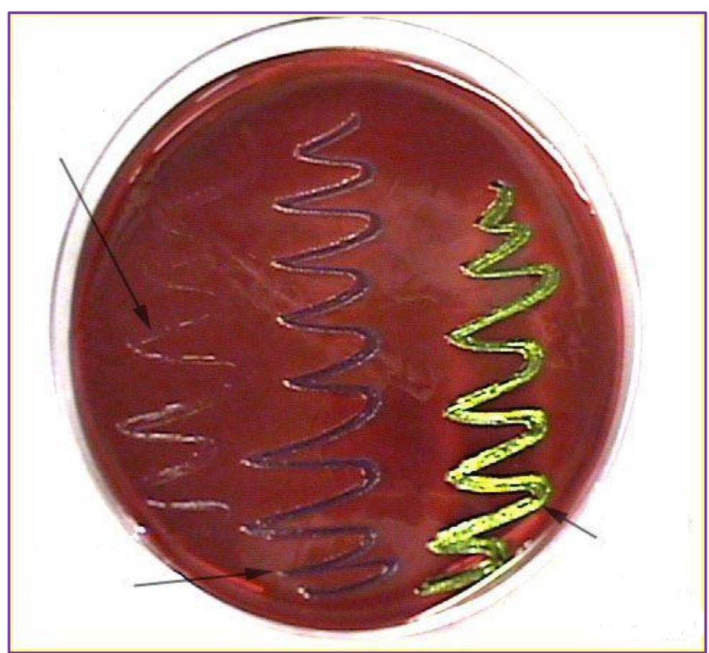 <p>Which streak indicates a positive result and can ferment lactose? </p>