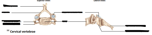 <p>Label the following:</p><ul><li><p>spinous process</p></li><li><p>lamina</p></li><li><p>transverse foramen</p></li><li><p>transverse process</p></li><li><p>vertebral body</p></li><li><p>superior articular facet</p></li><li><p>inferior articular process</p></li></ul><p></p>