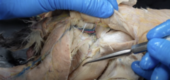 <p>What muscle is the probe pointing to?</p>