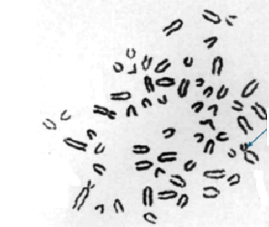 <p><span style="line-height: 20.85px;">Podaj zapis kariotypu przedstawionych poniżej przypadków (gatunek, liczbę chromosomów, płeć, rodzaj mutacji).<strong> </strong></span></p><p><span style="line-height: 20.85px;"><strong><u>Jeśli to możliwe</u></strong> wskaż chromosomy płci i ewentualne chromosomy które uległy mutacjom.</span></p>