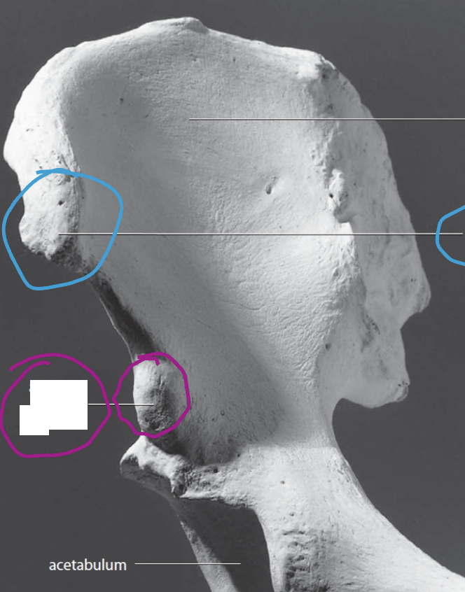 <p>Pelvis: What is the Purple?</p>