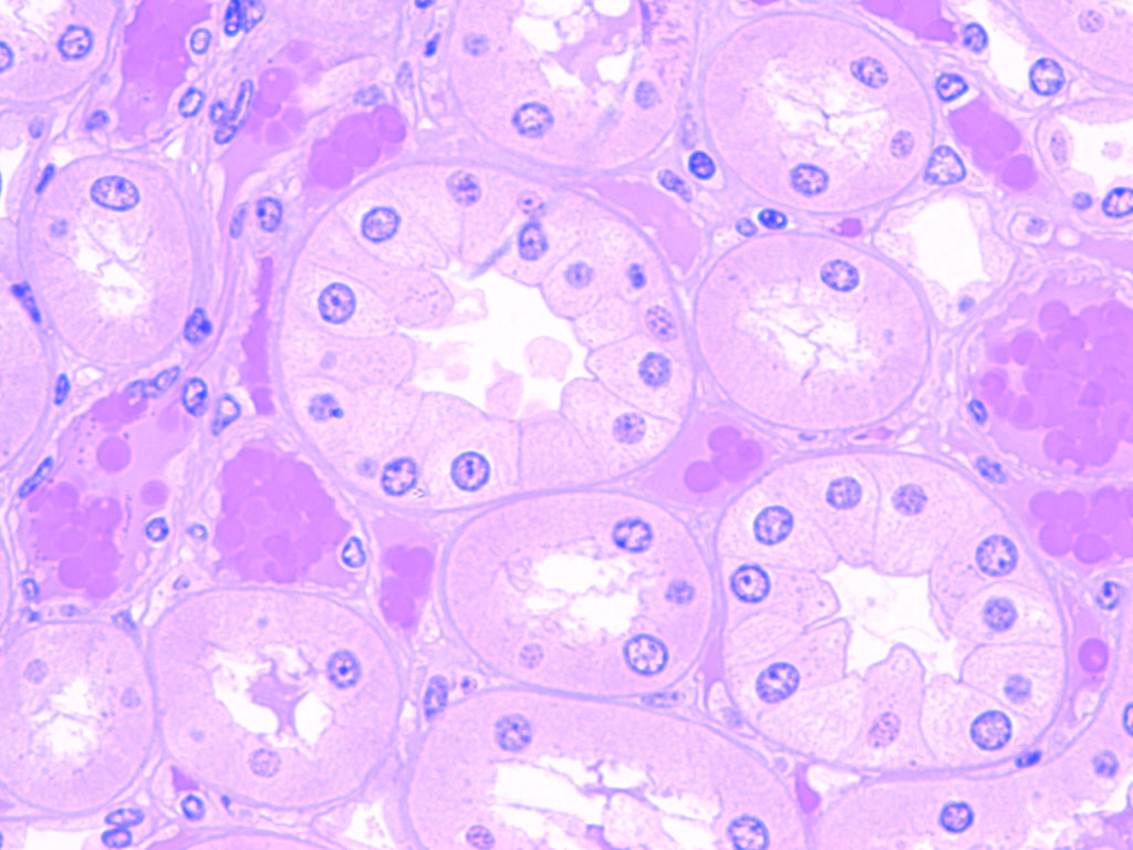 <ul><li><p>lumen - filtration flow site</p></li><li><p>apical - medial</p></li><li><p>basal - superficial with blood vessels</p></li><li><p>v2 receptor (vasopressin) - basolateral side, adh binds to it</p></li><li><p>v2 signal aquaporin - inserts on apical membrane, allows h2o to be absorbed</p></li></ul><p></p>