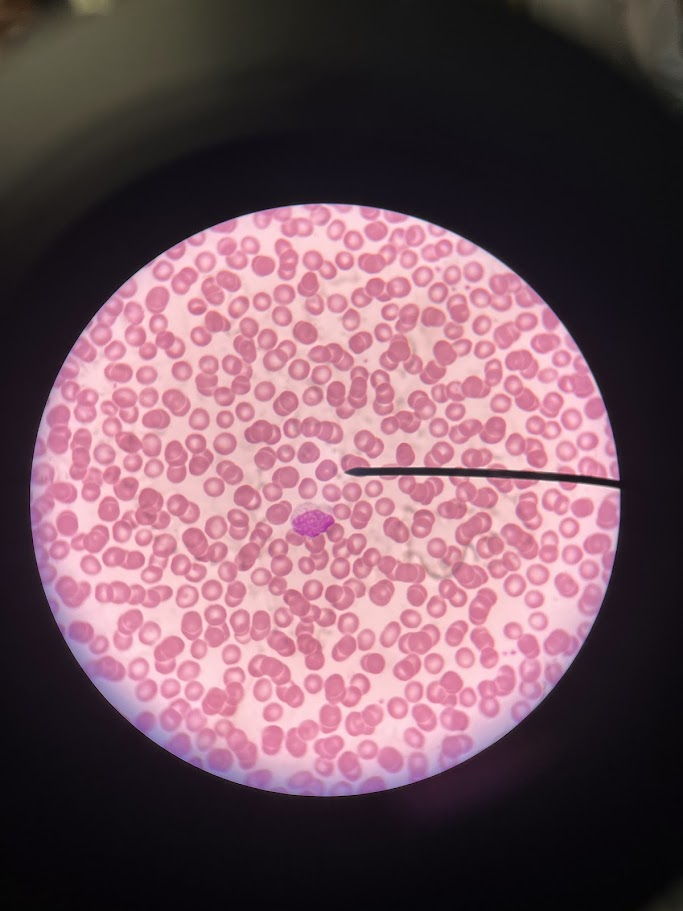 <p>The slide depicts which type of leukocytes</p>