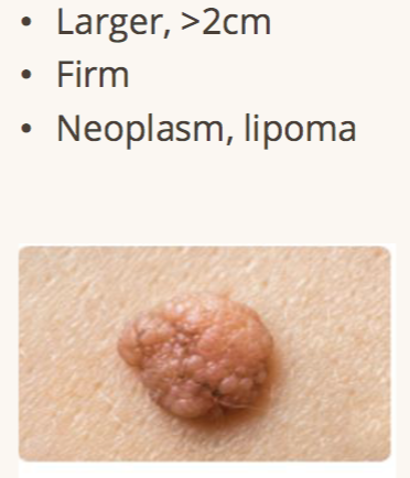 <p>primary lesion raised solid</p>