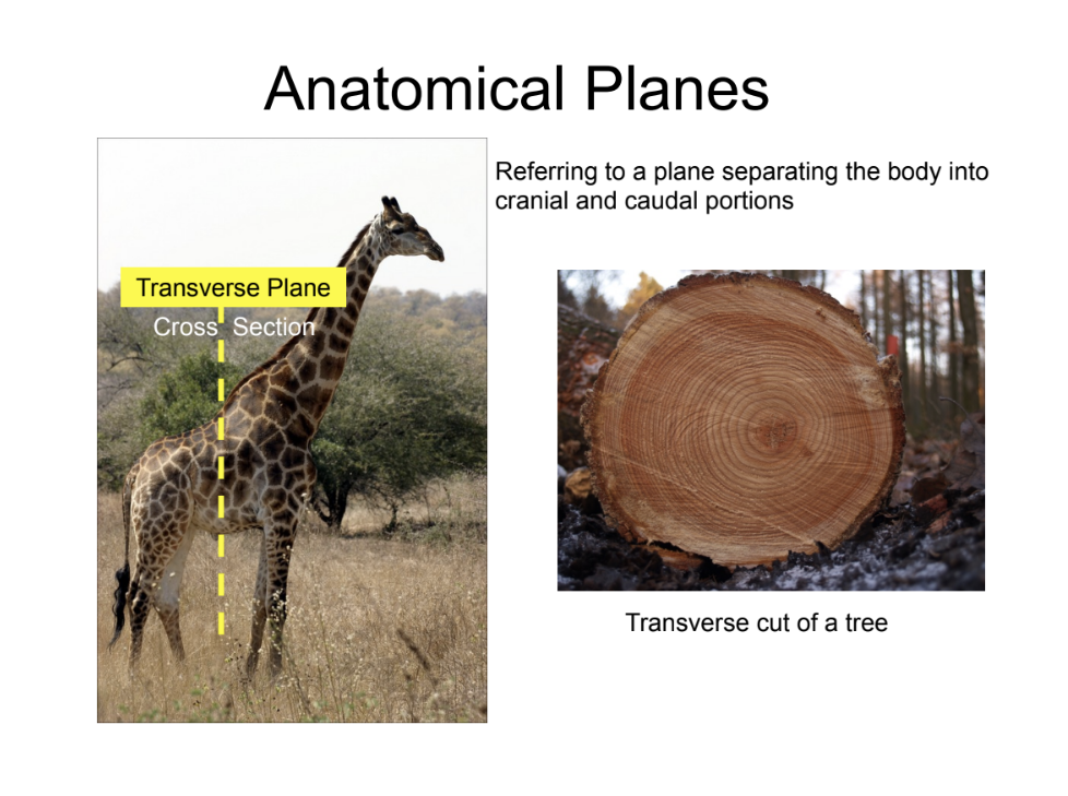 <p>transverse plane</p>