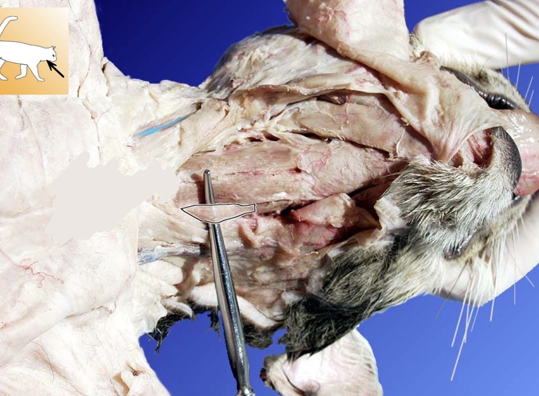 <p>Sternothyroid</p><p>Action: Depresses Thyroid Cartilage</p><p>Synergist:</p><p>Antagonist:</p>