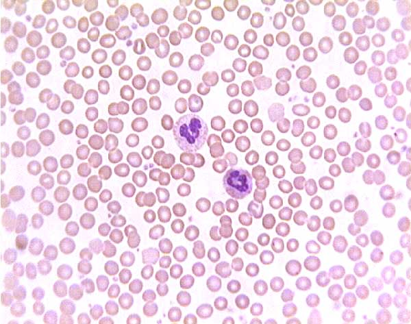 <p>Blood </p>