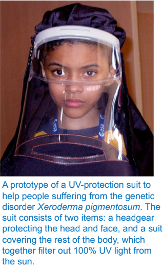 <ul><li><p>people affected by a rare skin disease Xeroderma pigmentosum (XP) have mutations in a number of human nucleotide- excision repair genes (responsible for correcting thymine dimers)</p></li><li><p>people with XP are extremely sensitive to sunlight or ultraviolet light - die from melanoma and other skin malignancies (cancers)</p></li><li><p>changes in the skin become evident in infancy and worsen with time - skin becomes dry, and there is a marked atrophy of the dermis</p></li></ul><p></p>