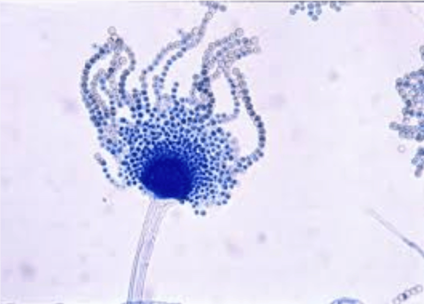 <p>Spiny conidiophores end in round vesicle</p>