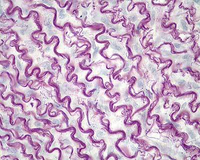 <p><strong>FIBRAS ELÁSTICAS (GENERALIDADES)</strong></p>