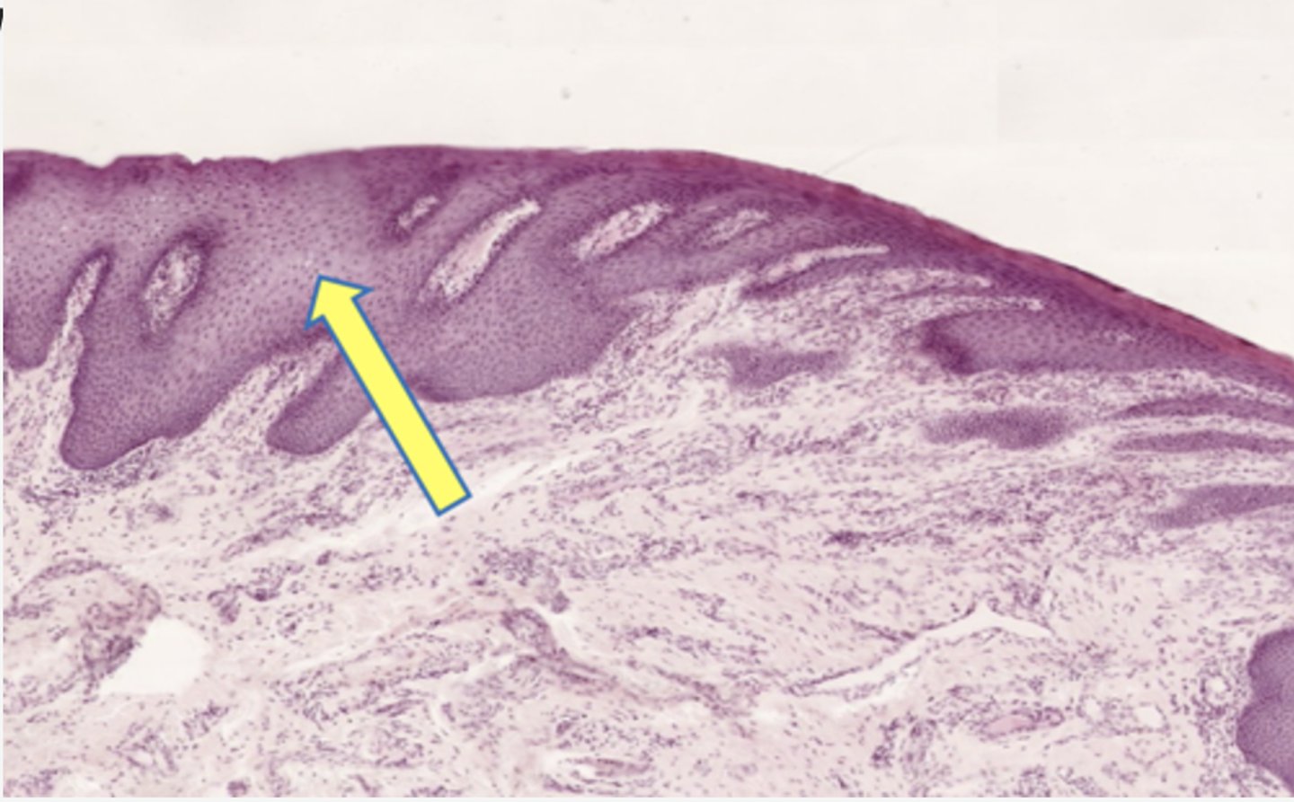 <p>Identify the mucosa</p>