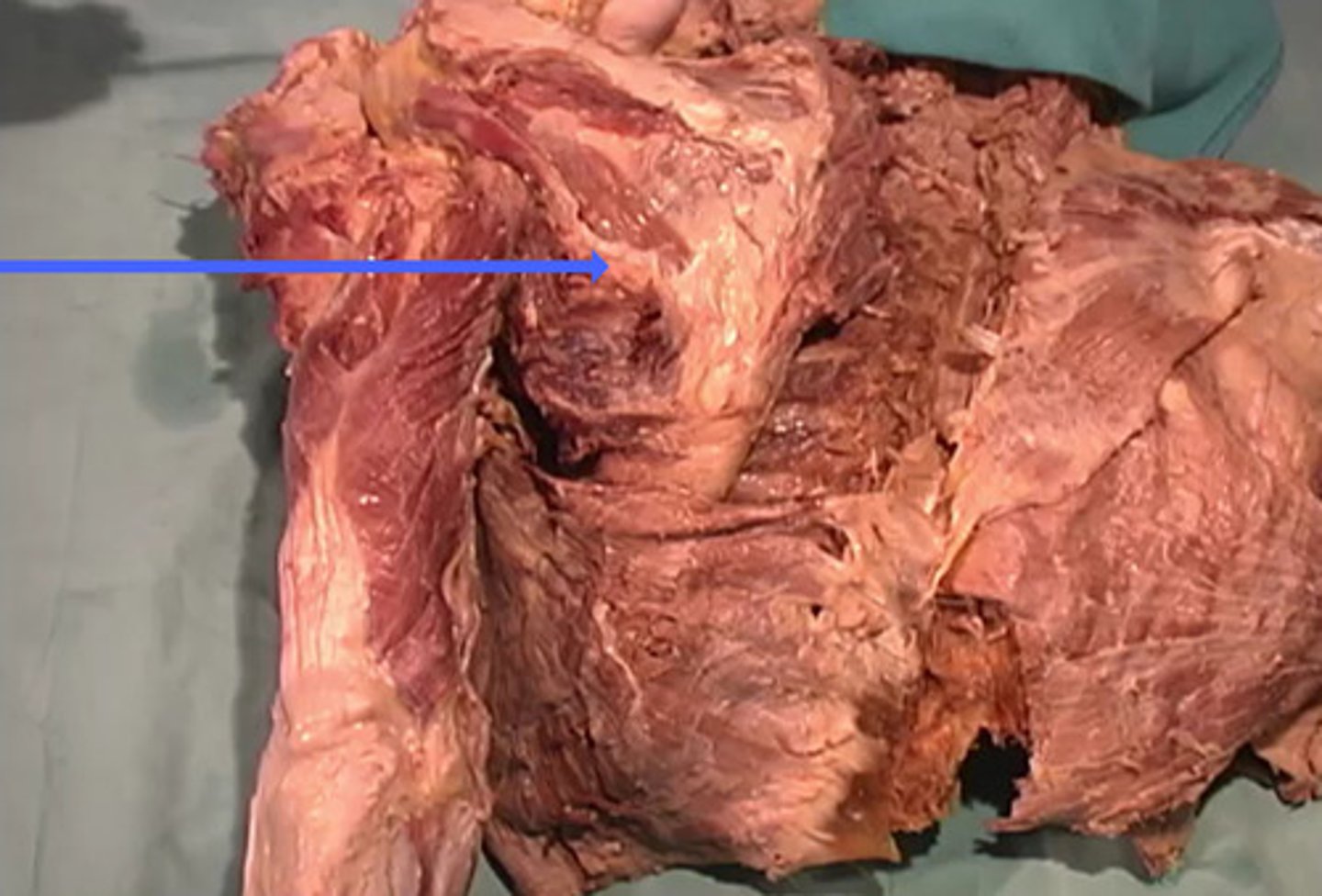 <p>What is the name of this muscle as indicated by the arrow?</p>