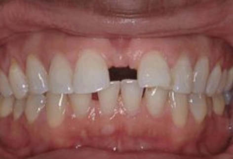 <p>What is this condition?</p>