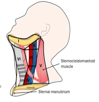 <p>Level V</p>