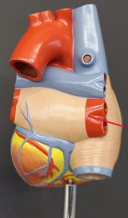 <p>Name the vein</p>