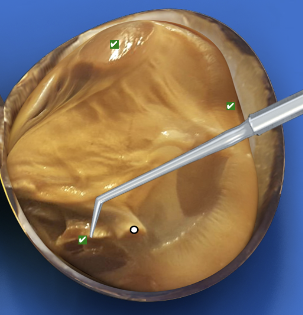 <p>What structure is this pointing to?</p>