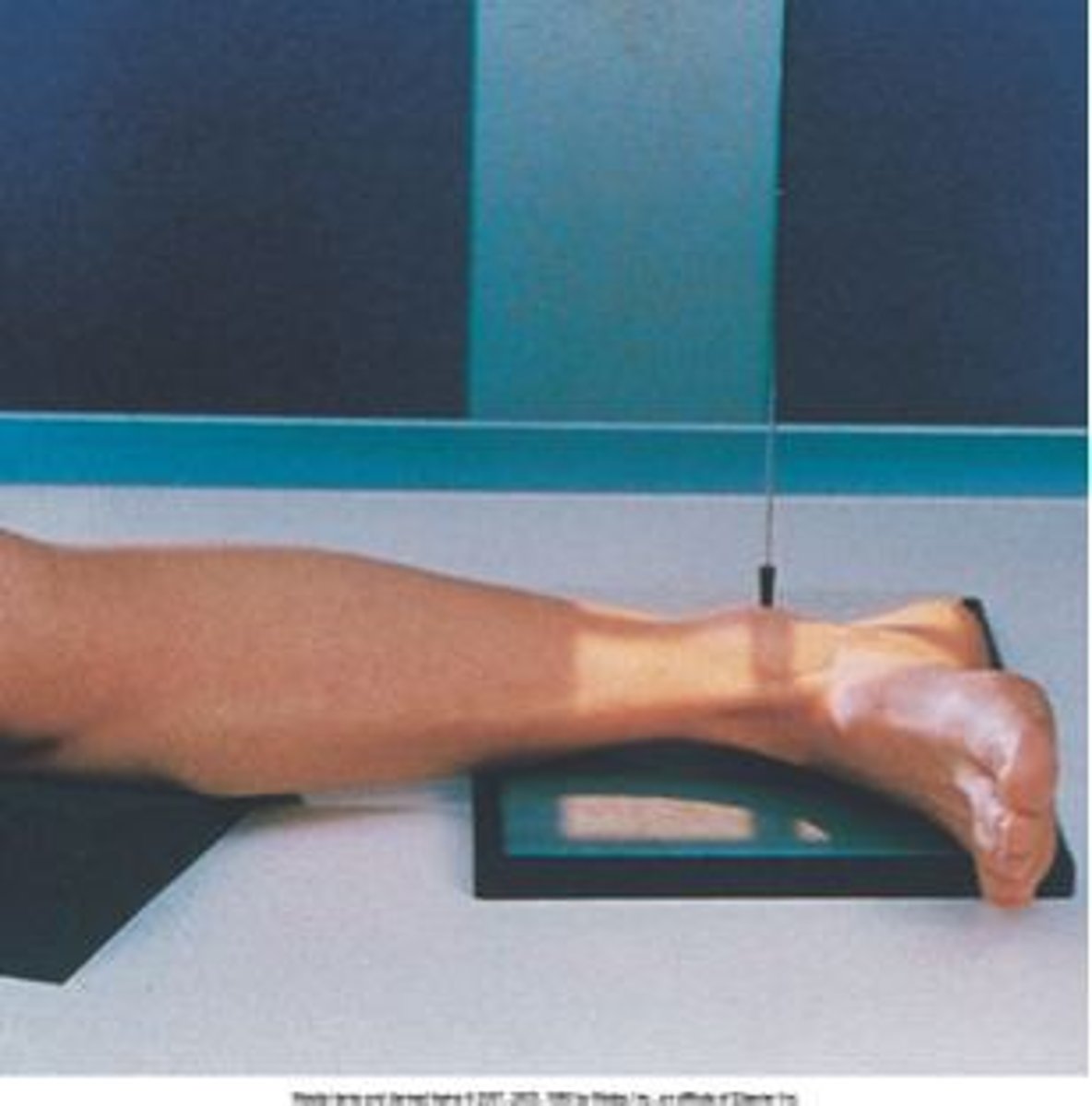 <p>S - on lap</p><p>T - 5 mAs @ 60 kVp</p><p>A - none</p><p>M - correct foot on cassette</p><p>P - lateral rotation, CR @ medial malleolus</p><p>S - 40"</p><p>B - hold</p><p>C - 10 x 12, C</p>